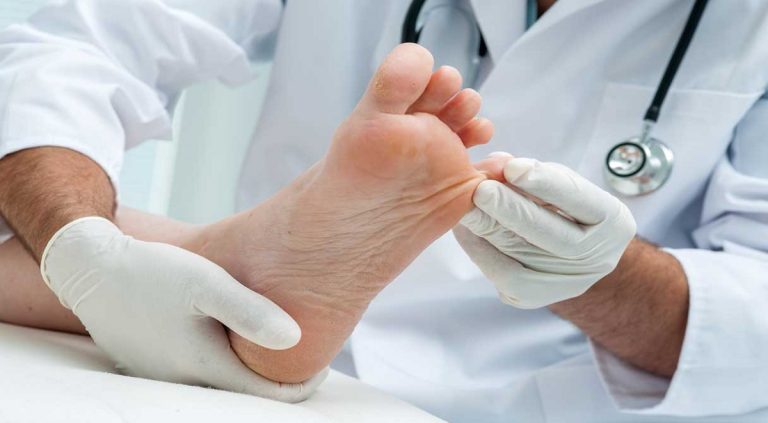 درمان میخچه با گوجه